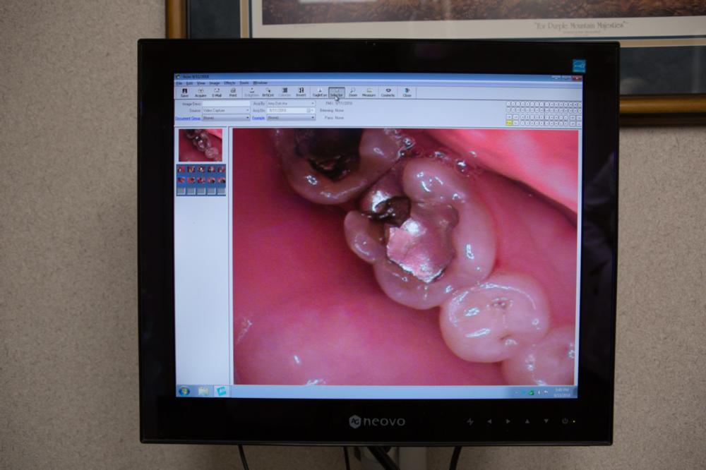 intraoral camera st paul mn